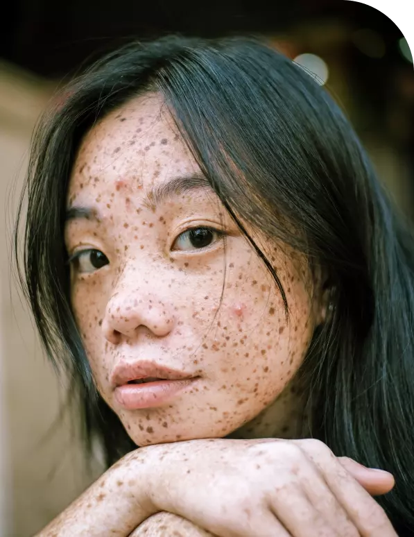 a girl with freckles